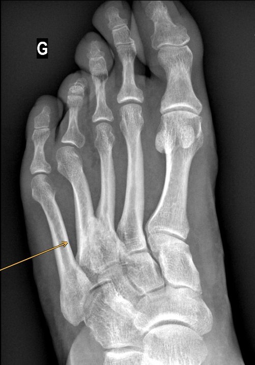 cas du mois fig.01