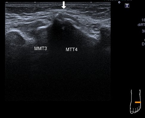 cas du mois fig.03
