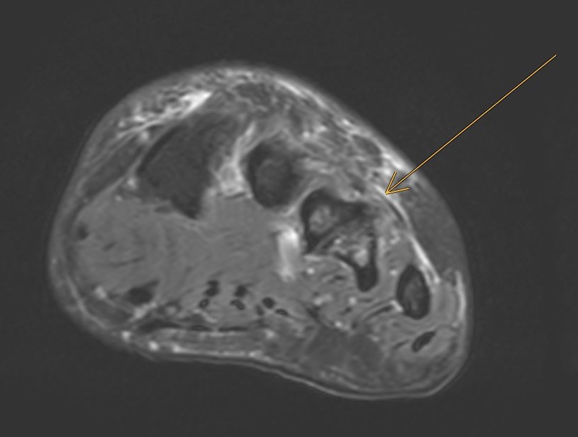 cas du mois fig.04