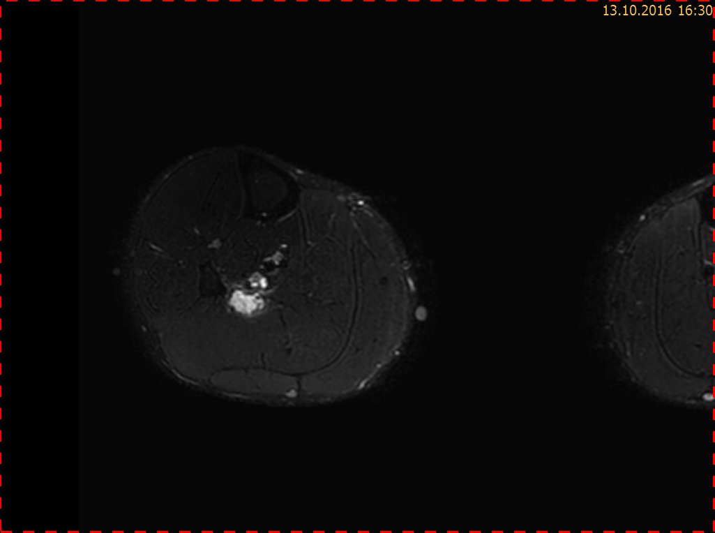 cas du mois fig.02