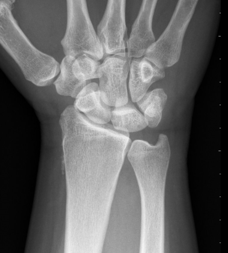 cas du mois fig.01