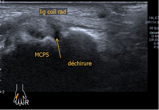 MPC5 fig.03