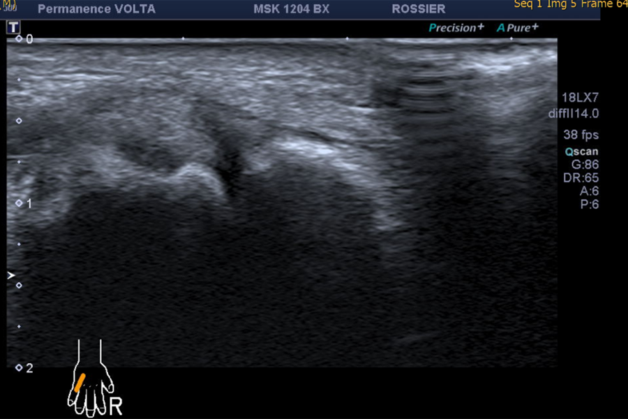MPC5 fig.04